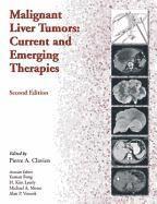 bokomslag Malignant Liver Tumors