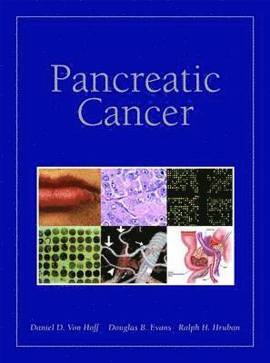 bokomslag Pancreatic Cancer