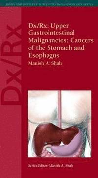 bokomslag Dx/Rx: Upper Gastrointestinal Malignancies: Cancers of the Stomach and Esophagus