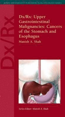 Dx/Rx: Upper Gastrointestinal Malignancies: Cancers of the Stomach and Esophagus 1