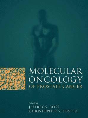 bokomslag Molecular Oncology of Prostate Canc