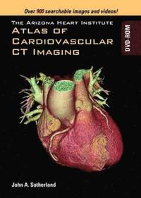 bokomslag Arizona Heart Institute Atlas of Cardiovascular CT Imaging DVD-ROM