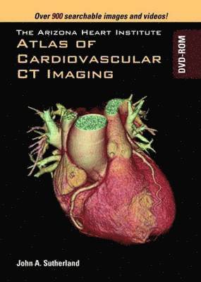 Arizona Heart Institute Atlas of Cardiovascular CT Imaging DVD-ROM 1