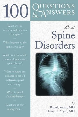 100 Questions  &  Answers About Spine Disorders 1