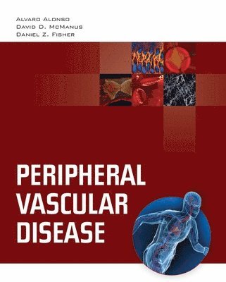 bokomslag Peripheral Vascular Disease