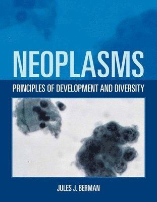 Neoplasms: Principles of Development and Diversity 1