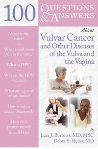 bokomslag 100 Questions & Answers About Vulvar Cancer and Other Diseases of the Vulva and Vagina