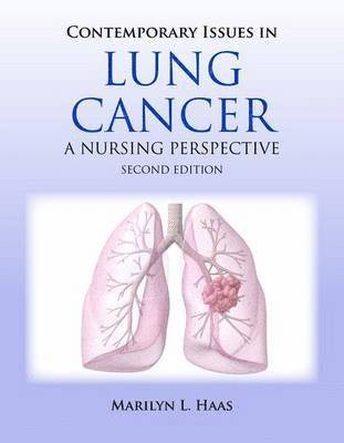 bokomslag Contemporary Issues In Lung Cancer