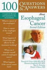 bokomslag 100 Questions  &  Answers About Esophageal Cancer