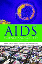 AIDS 1