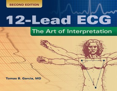 bokomslag 12-Lead ECG: the Art of Interpretation