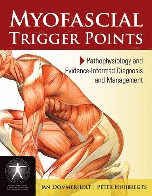 Myofascial Trigger Points: Pathophysiology and Evidence-Informed Diagnosis and Management 1