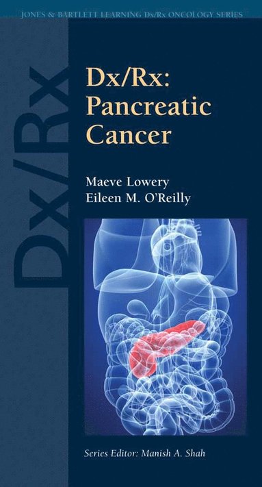 bokomslag Dx/Rx: Pancreatic Cancer