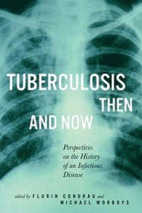 bokomslag Tuberculosis Then and Now