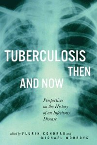 bokomslag Tuberculosis Then and Now: Volume 37