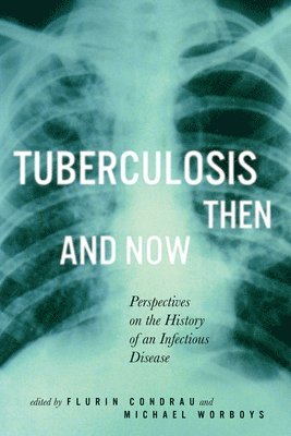 Flurin Condrau, Michael Worboys - Tuberculosis Then and Now, Inbunden