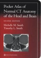 bokomslag Pocket Atlas of Normal CT Anatomy of the Head and Brain