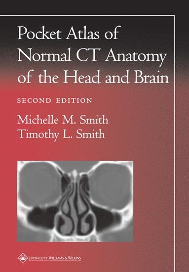 bokomslag Pocket Atlas of Normal CT Anatomy of the Head and Brain