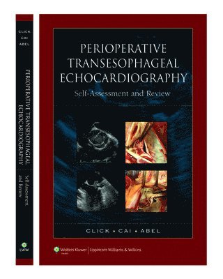 bokomslag Perioperative Transesophageal Echocardiography Self-Assessment and Review