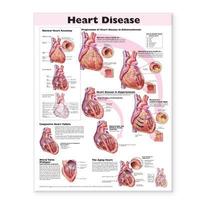 bokomslag Heart Disease Anatomical Chart