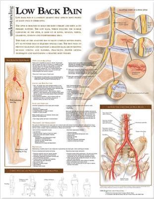 Understanding Low Back Pain Anatomical Chart 1