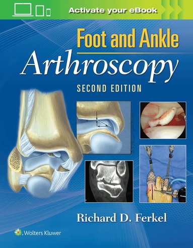 Richard D Ferkel - Foot & Ankle Arthroscopy, Inbunden
