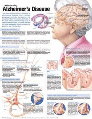 bokomslag Understanding Alzheimer's Disease Anatomical Chart