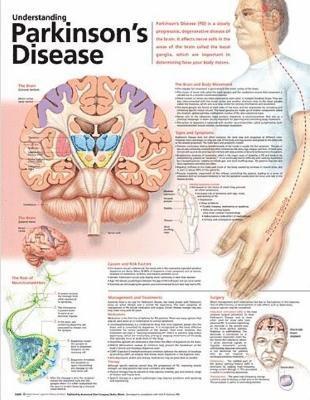 Understanding Parkinson's Disease Anatomical Chart 1