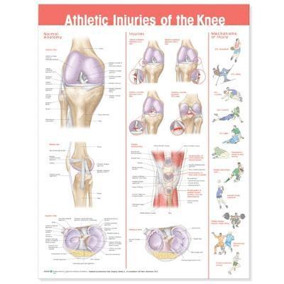 Athletic Injuries of the Knee Anatomical Chart 1