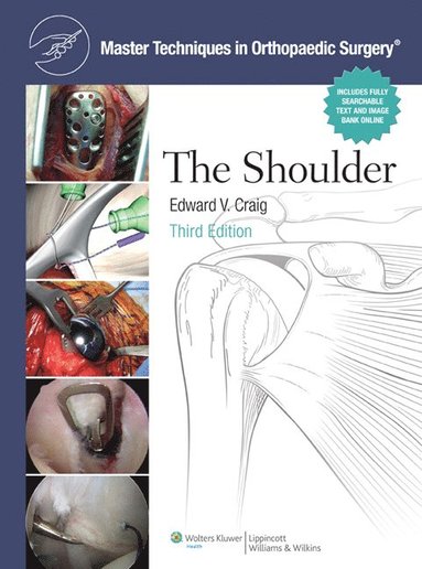 bokomslag Master Techniques in Orthopaedic Surgery: Shoulder