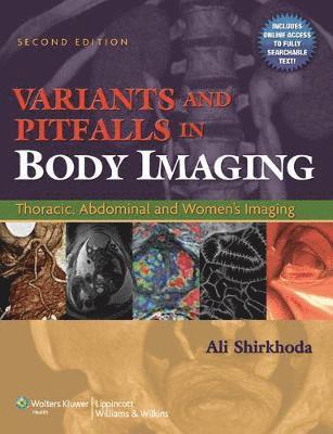 Variants and Pitfalls in Body Imaging 1