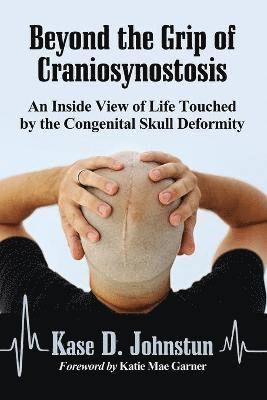 bokomslag Beyond the Grip of Craniosynostosis