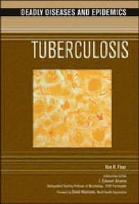 bokomslag Tuberculosis