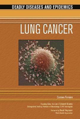 Carmen Ferreiro - Lung Cancer, Inbunden. Tillgänglighet: Tillfälligt slut