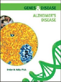 bokomslag Alzheimer's Disease