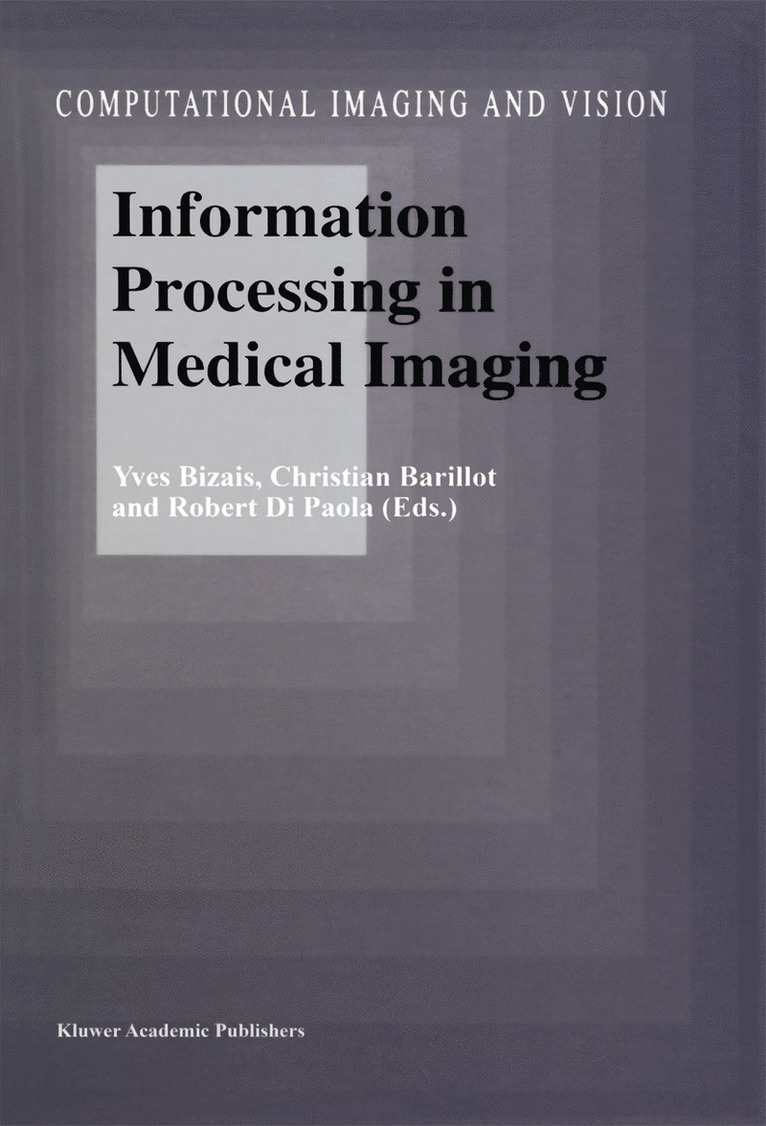 Information Processing in Medical Imaging 1