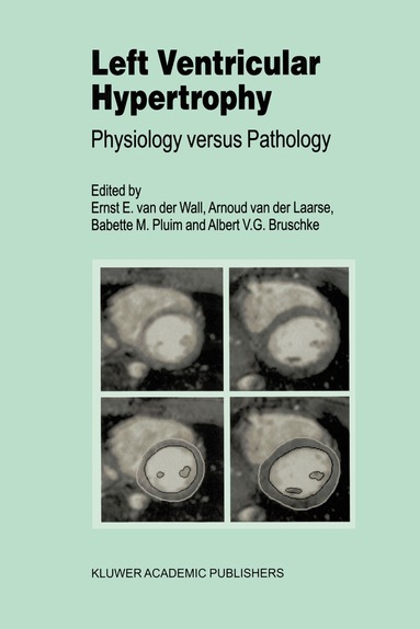 Ernst E. van der Wall, A. van der Laarse, Babette M. Pluim, A.V. Bruschke - Left Ventricular Hypertrophy, Inbunden