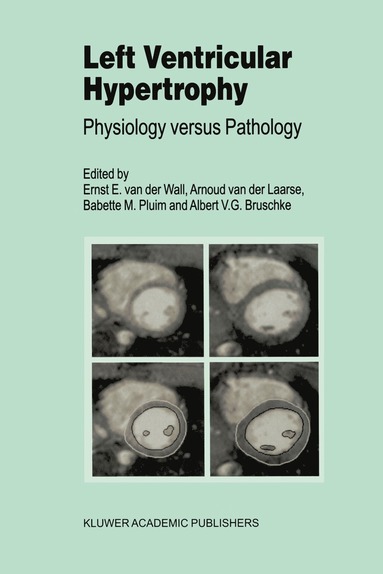 bokomslag Left Ventricular Hypertrophy