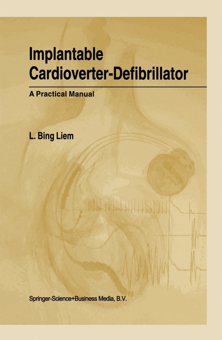 L. Bing Liem - Implantable Cardioverter-Defibrillator, Inbunden