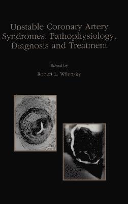 bokomslag Unstable Coronary Artery Syndromes Pathophysiology, Diagnosis and Treatment