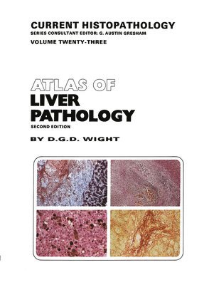 bokomslag Atlas of Liver Pathology