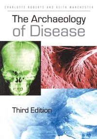 bokomslag The Archaeology of Disease
