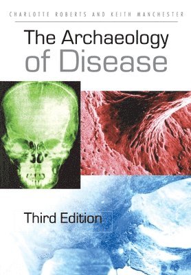 The Archaeology of Disease 1