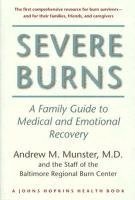 bokomslag Severe Burns