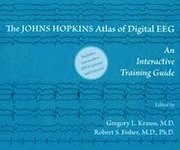 bokomslag The Johns Hopkins Atlas of Digital EEG