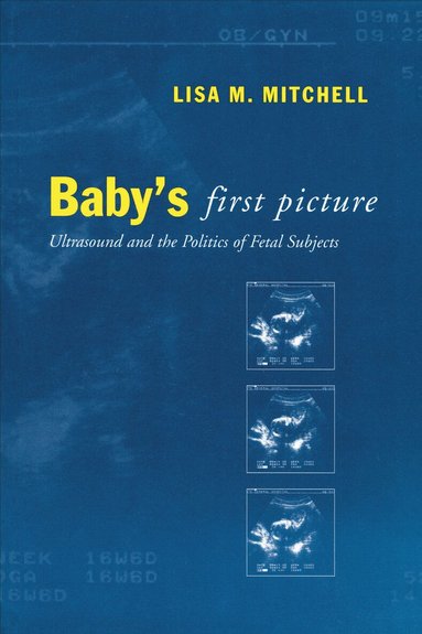 Lisa M. Mitchell - Baby's First Picture, Häftad