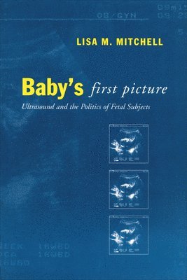Baby's First Picture 1