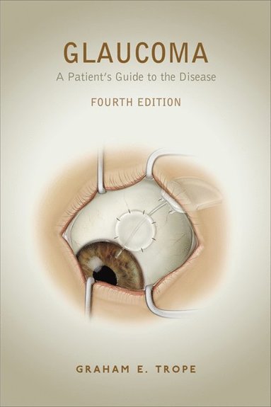 bokomslag Glaucoma