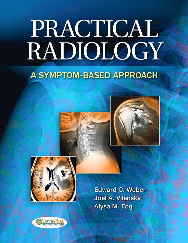 Edward C. Weber, Joel A. Vilensky, Alysa Fog, Edward C Weber, Joel A Vilensky, Alysa M Fog - Practical Radiology, Häftad