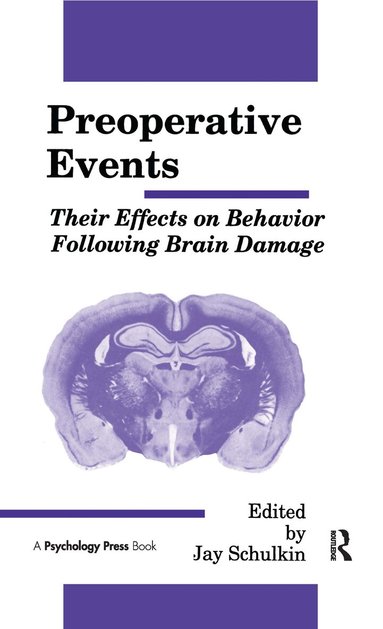 Jay Schulkin - Preoperative Events, Inbunden